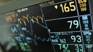 si-heart-monitor-220-cp-372