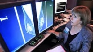 si-mammogram-220-cp-0128321