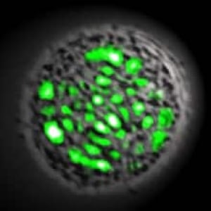 sm-220-living-laser