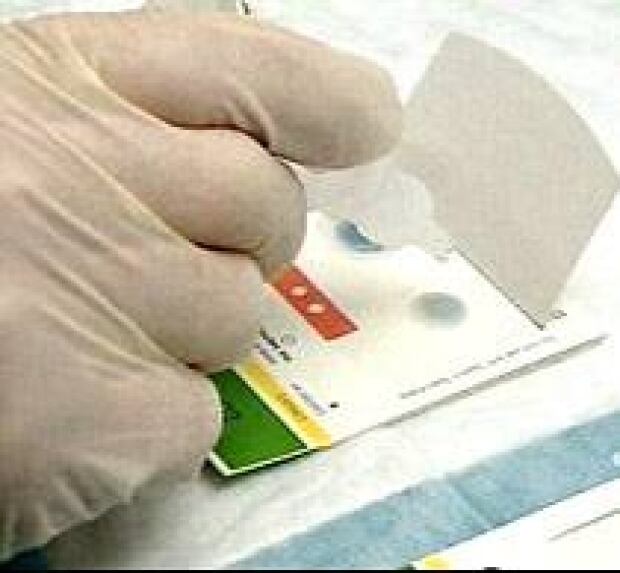 Ontario introduces 193m colon cancer screening program cbc news