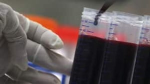 tp-hiv-vaccine-cp-2485124