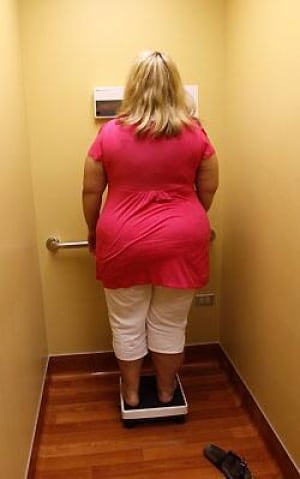 obesity-weigh-cp-rtxt14p