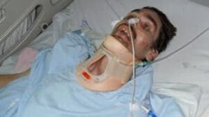sk-mb-injured-lafortune-2-f