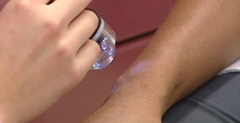 Dark Skinned Immigrants Urged To Take Vitamin D Cbc News