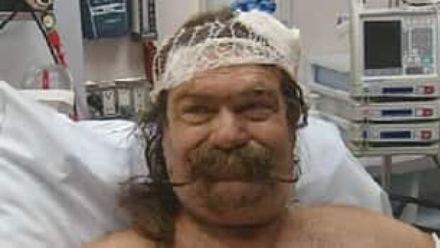Bear attacks 2 Vancouver Island men | CBC News