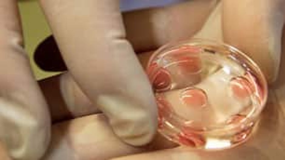 A doctor prepares eggs and sperm for an attempt at artificial insemination.