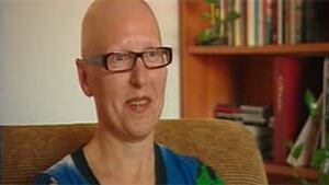 tp-macgregor-chemo-hair-291