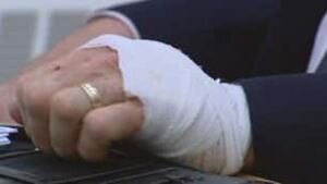 sk-stewart-hand-091029