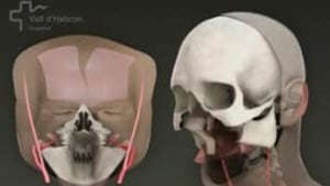 tp-face-surgery-cp-8537583