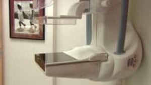 wdr-mammography-machine