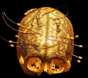 brain-language-model-300
