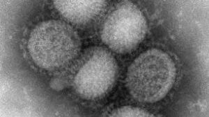 tp-swineflu-cp-RTXEI3D