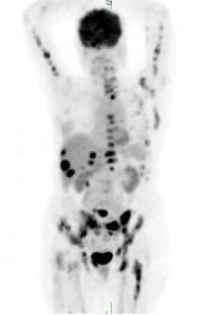 petscan-2