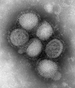 swineflu-cp-RTXEI3D