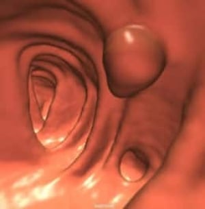 colon-cp-5532785
