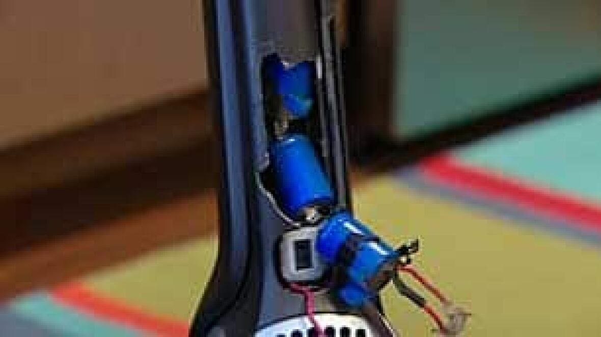 Electrolux vacuum explodes, causing thirddegree burns CBC News