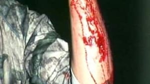 bc-091016-grizzly-forearm-photo