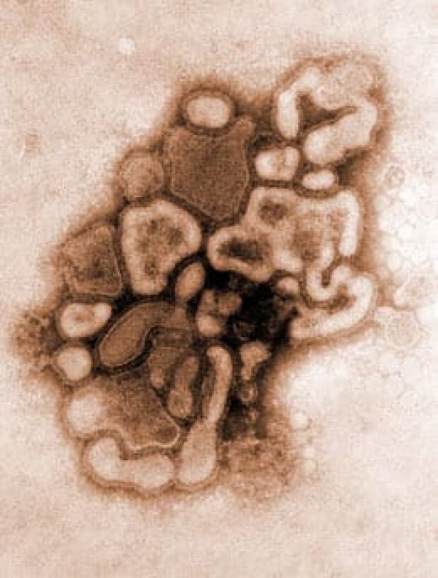 flu-cp-RTXECC9
