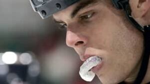 mouthguard_306