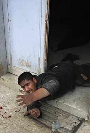 injured-palestinian-cp-250-