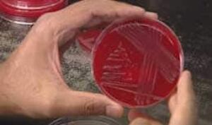 listeria-culture-cbc