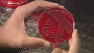 tp-listeria-culture-cbc