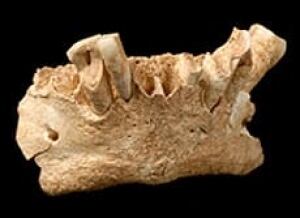 mandible