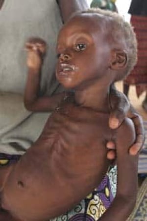 niger_starvingchild_cp_8122447