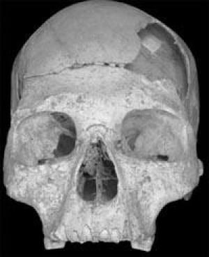 skull-cp-2270900