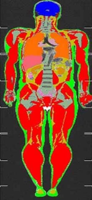 fat-thin-cp-051011A