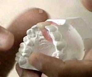 ultrasound-tooth060629