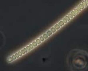 cyanobacteria2_brmma