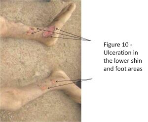 Syria torture photo