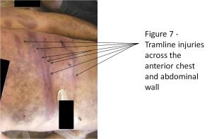 Syria torture photographs
