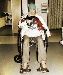 a cracked vertebra and a fractured skull