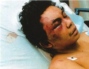 Inmate beaten
