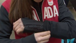 Maelle Ricker splint