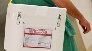 Organ transplant