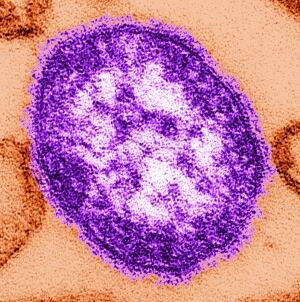Measles Mexico 20130308