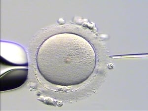 In-vitro fertilization