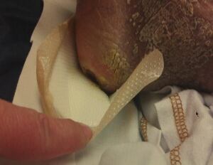 Scurlock foot hospital injury