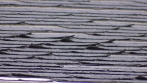 Shingles