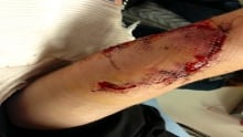 arm.injury.sean.Llyod