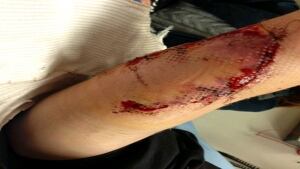 arm.injury.sean.Llyod