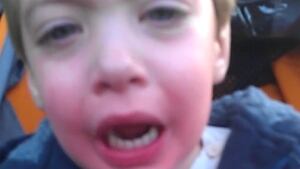 Dayton Barratt, 2, pepper-sprayed - red face