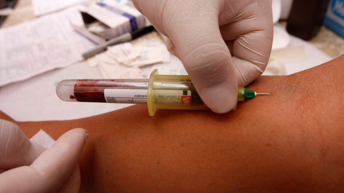 Sask. HIV rate highest in Canada, up 800% in 1 region