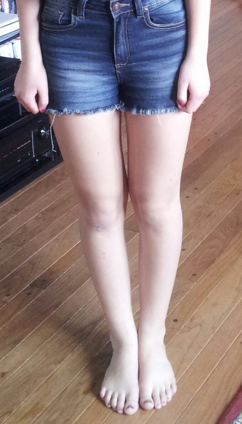 short dress shorts