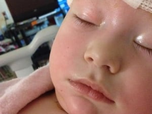 Baby Charlie Chubbs after her operation