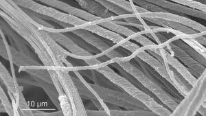 Fossil ostracod sperm