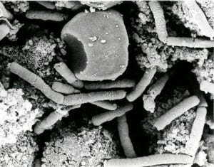 CDC Anthrax